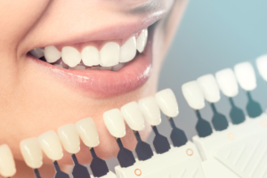 Cosmetic Dentistry Procedures That You Should Know About
