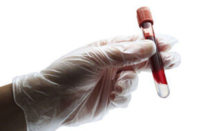 Four Things You Must Know Before a Blood Test